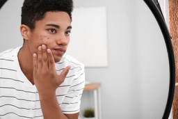 Acne: causes, diagnosis and treatment