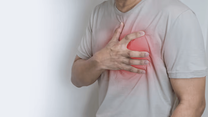 Management of heartburn in community pharmacy
